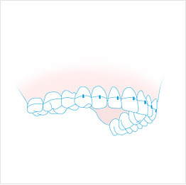 교정 일러스트