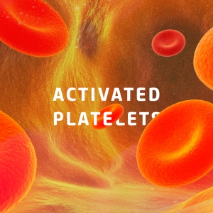 GMS BIOTECH 워드프레스 맞춤 테마 개발